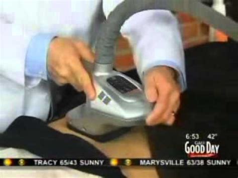 velashape sacramento|Good Day Sacramento with Dr. Shieh and VelaShape .